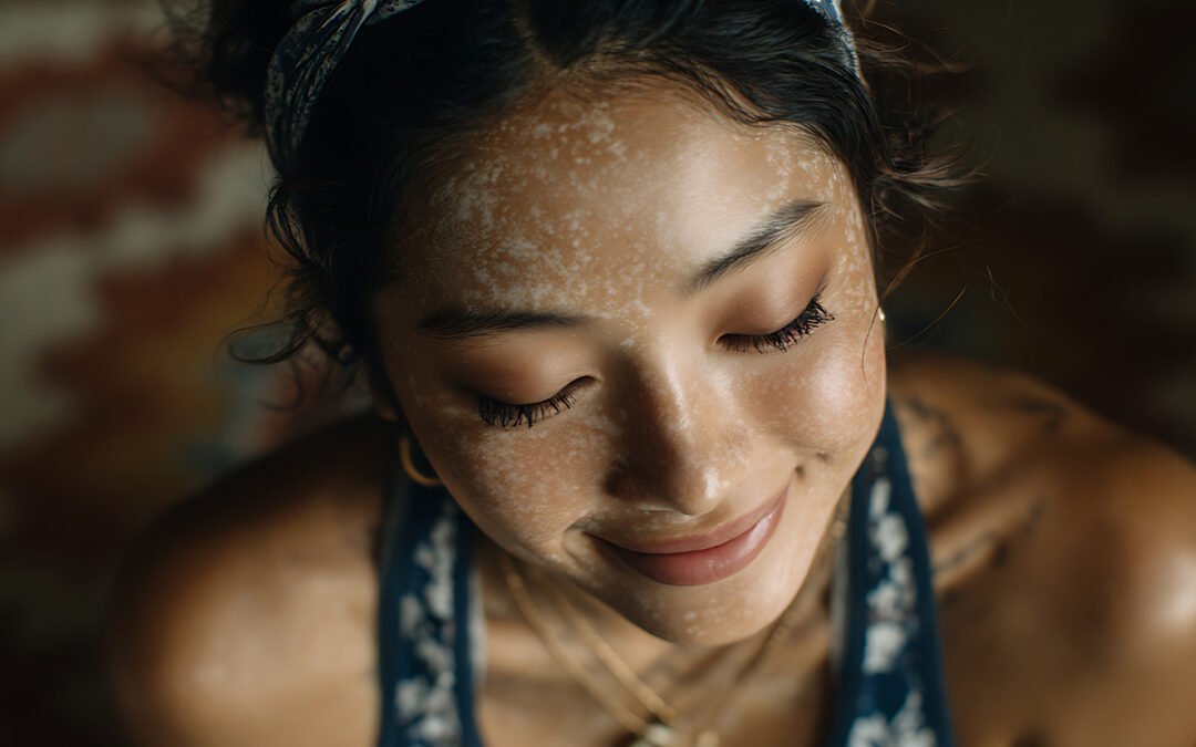 Cuidados antes e depois da Sessão de Fototerapia: Guia Prático Para Pacientes 